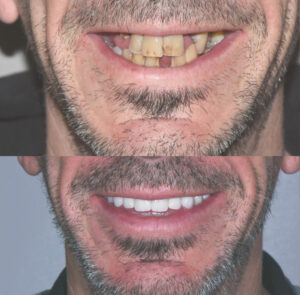 Esthétique dentaire Marseille - Cabinet dentaire Drs Damiani et Richelme - Dentiste Marseille