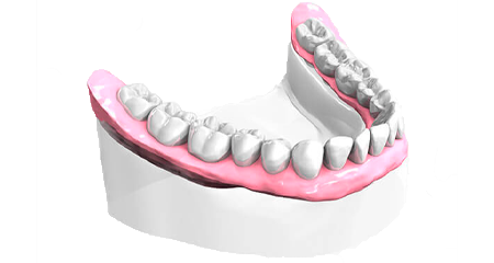 Soins dentaires - Cabinet dentaire Drs Damiani et Richelme - Dentiste Marseille